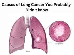 Causes of Lung Cancer You Probably Didn't know